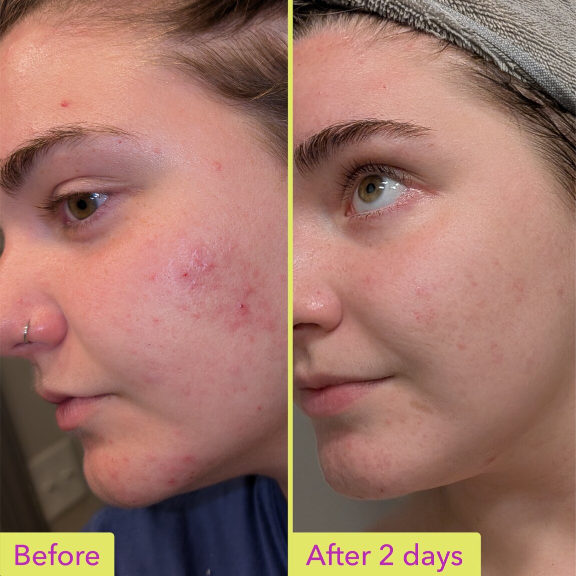 Good Molecules 10% Azelaic Acid Treatment 30ml alternative view 4.