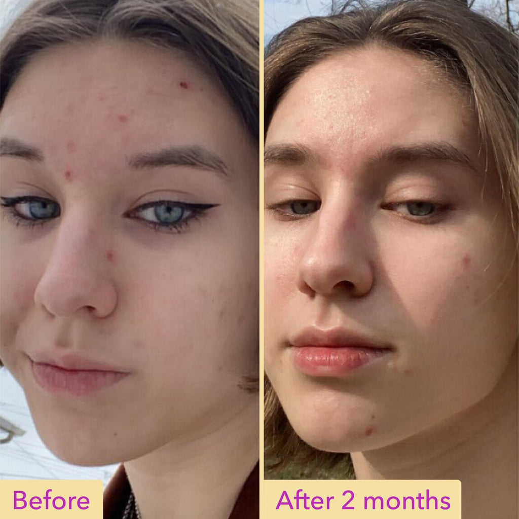 Good Molecules Niacinamide Serum 30ml alternative view 3.