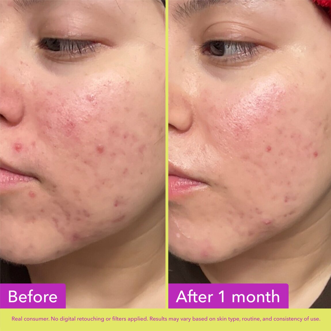 Good Molecules 10% Azelaic Acid Treatment 30ml alternative view 5.